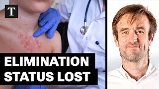 UK Loses Measles Elimination Status Over Accessibility Failures | Tom Whipple