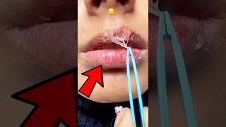 How to Fix Dry Lips in Seconds