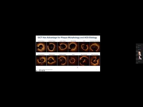 Intravascular Imaging - Dr Daniel Chamie - Oct 19 2022
