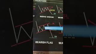 Most Reliable Reversal Patterns for Safe Trading  #TrendReversal #SafeTrading #TechnicalAnalysis