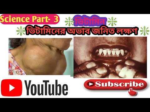 ভিটামিন কী? ||  পুষ্টি || প্রোটিন কী? ||  রোগ সমূহ || pusti kake bole bangla