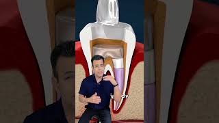 Root canal treatment by top dentist Delhi #youtubeshorts #youtubevideo #youtubeindia #youtubechannel