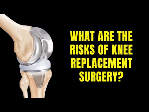 What Are the Risk Of Knee Replacement Surgery