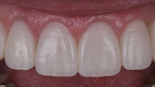 Earn CEUs: Noninvasive Smile Enhancement Course from the AACD