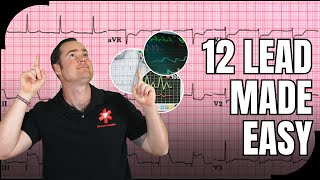 Master 12-Lead ECG Interpretation in 1 video