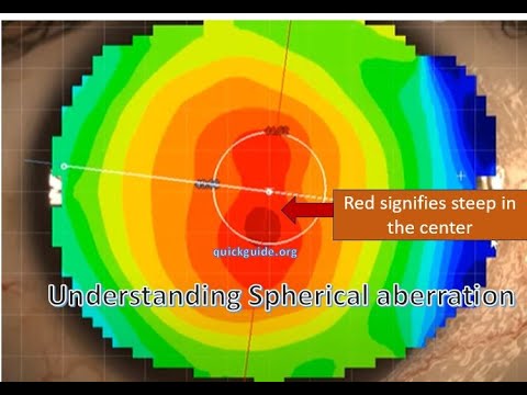 Understanding Spherical Aberration and aspheric IOLs- Part II (follow quickguide.org)
