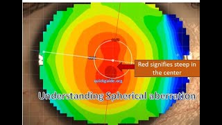 Understanding Spherical Aberration and aspheric IOLs- Part II (follow quickguide.org)