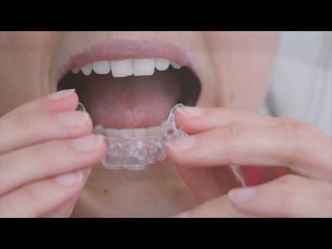 Retainer Care
