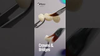 Chairside made simple with Rodin® Glaze N2-Free #dental3dprinting #dentalwork  #digitaldentistry