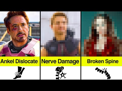 Marvel Actors Who Got LIFELONG Disabilities From Filming