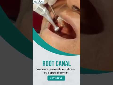 Root canal treatment #rootcanaltreatment #rootcanalrecovery #rootcanalspecialist #dentalhealth