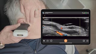 Ultrasound of Basal Cell Carcinoma