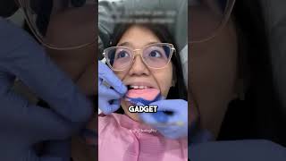 Really Unexpected Teeth Whitening Gadget 😲