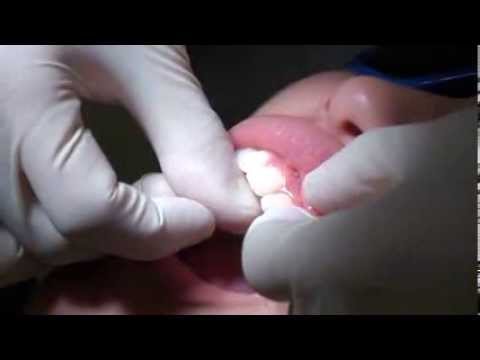 Dr Samson Chan teach you how to floss your teeth