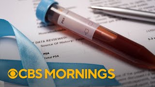 How early detection of prostate cancer can save lives