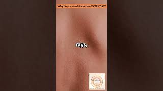 UV Rays : The Invisible Skin Agers!