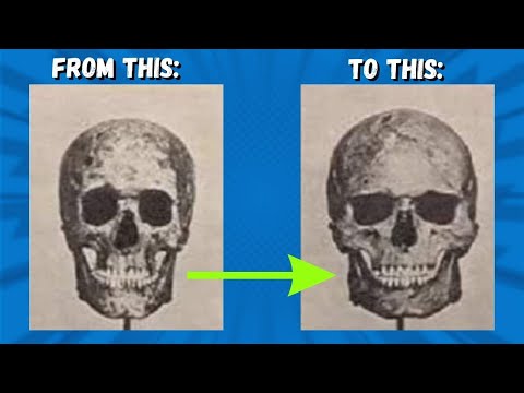 how to change the bonestructure of your face