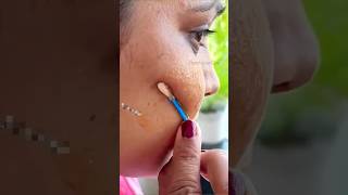 ✨✅🧿Pigmentation Solution At Home||Pigmentation Naturally Remove At Home#ytshorts#shortsfeed#skincare