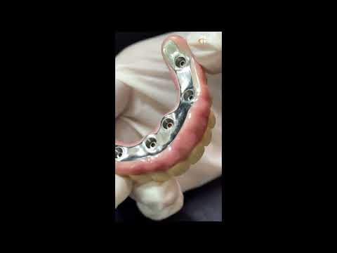 The Finest Quality Dental Laboratory in Thailand.
