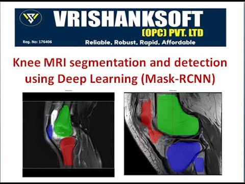Knee bone segmentation using deep learning (Mask-RCNN)- Detect knee types: Femur, Tibia, and Patella