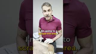 Understanding ED&C: A Comprehensive Guide to Basal Cell Carcinoma Treatment #skincancer #skincare