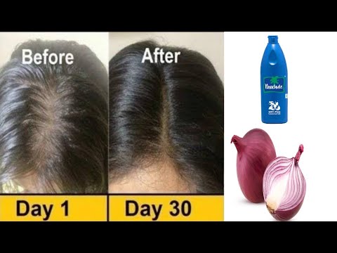 Homemade onion oil for hair growth|| how to make onion oil at home||  homemade oil|| shorts