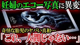 [Scary Story] [Viewer Discretion Advised] The Shocking Truth Behind the Bizarre Fetus in an Ultra...