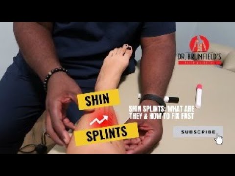 Shin Splints Causing Pain? Here's What You Need to Know