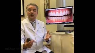 No porcelain veneers, Bioclear veneers save money and tooth structure
