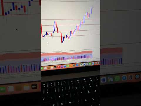 Gold New High 3000$ | Dip Buy Entries #trading #xauusd