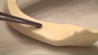 AnyRidge Implant Placement Demonstration