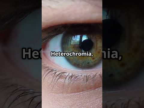 Why Do Some People Have Two Different Eye Colors? | Truthly Explains Heterochromia