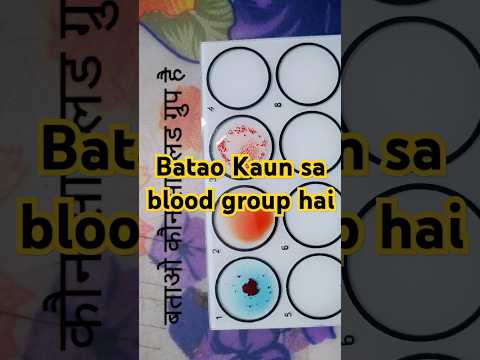 Blood Group | Blood group test | Blood group Physiology practical | Blood group A Positive | #short
