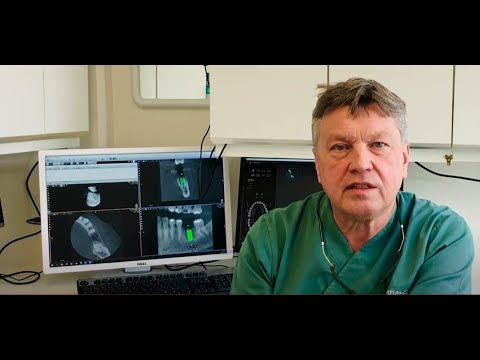 Don't miss Prof. Lars Sennerby's live webinar