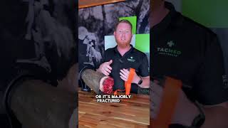 How To Apply The SOF Tourniquet