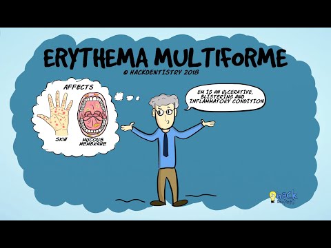 Erythema multiforme