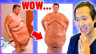 How Do You Remove All That Skin?? Plastic Surgeon Reacts to SKIN TIGHT