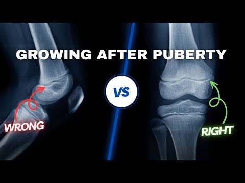 You Can Grow Taller After Puberty [SCIENTIFIC BREAKTHROUGH]