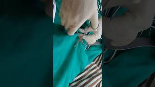 obsgyne instruments towel clip@saisamarthgyneclasses#shortsclip#obstetrics#medical