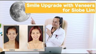 Beautiful and Sexy Siobe Lim got Veneers | Smile Enhancement | Apostol Dental