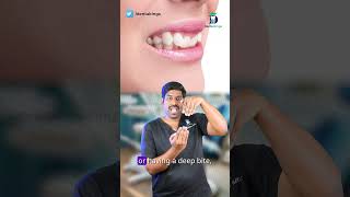 மேல் பல்லில் மட்டும் கிளிப் போட்டார்களா? - Braces on upper teeth only | Dr.karthikeyan | Denta Kings