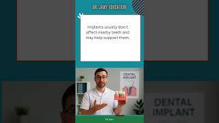 19 "What Are Dental Implants? Explained in 60 Seconds 🦷"