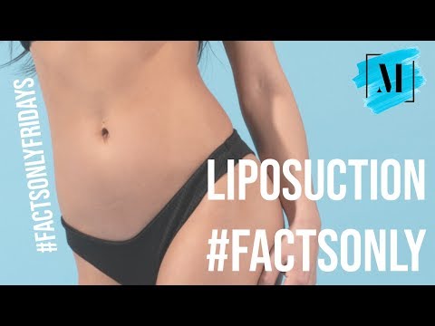 Liposuction Toronto | Facts only with Dr. McEvenue