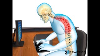 Understanding Tech Neck: Causes, Symptoms, and Solutions w/ Dr. Chad Patrick of TexStar Chiropractic