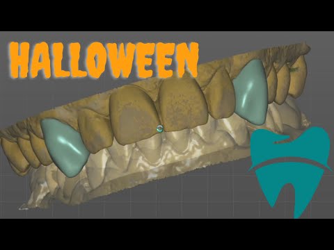 EXOCAD Design - Vampire Teeth For HALLOWEEN