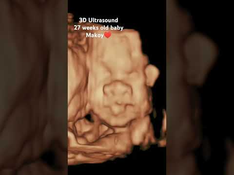Witness the wonder of a 3D ultrasound capturing precious moments #3DUltrasound #MiracleOfLife"