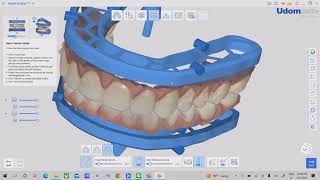 Medit- Model Builder Workflow (Burmese audio)