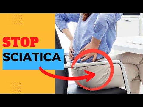 How to Fix Sciatica: 25 Tips and Tricks to Stop Sciatica