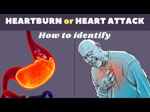 Heart attack or Heartburn | Heart attack symptoms | Acid reflux symptoms