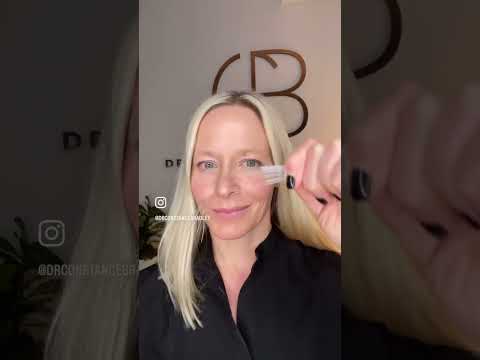 More facial acupuncture for marionette lines